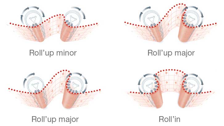 endermologie-roll-technology