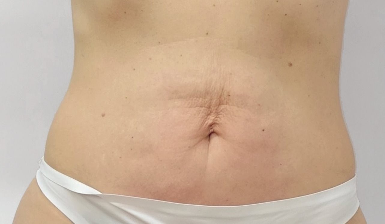 after image