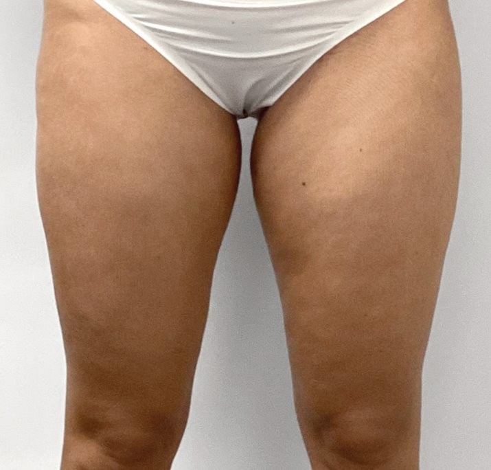after image