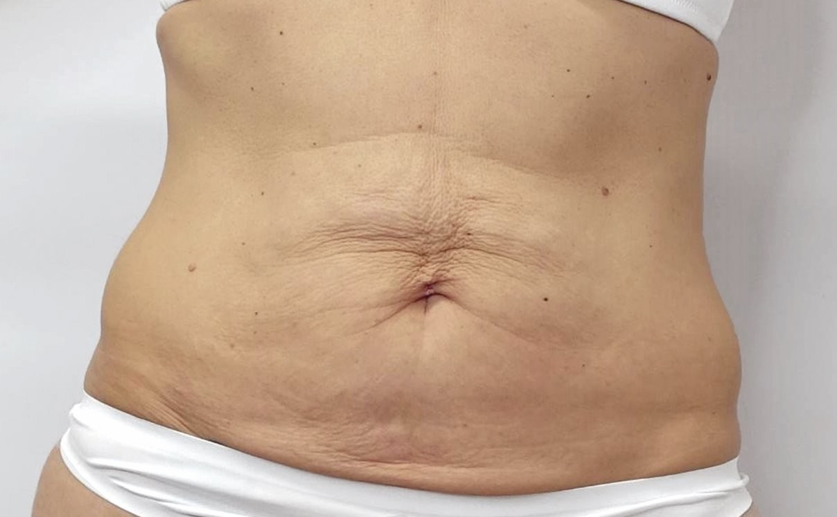 before image